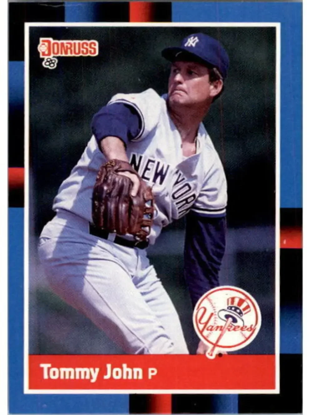 1988 Tommy John Donruss Baseball Card #401